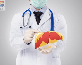 Gan nhiễm mỡ độ 1 có được coi là mức độ nguy hiểm không? Tìm hiểu ngay để biết