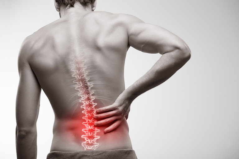 Thoát vị đĩa đệm ở người trẻ tuổi – nguyên nhân và cách điều trị