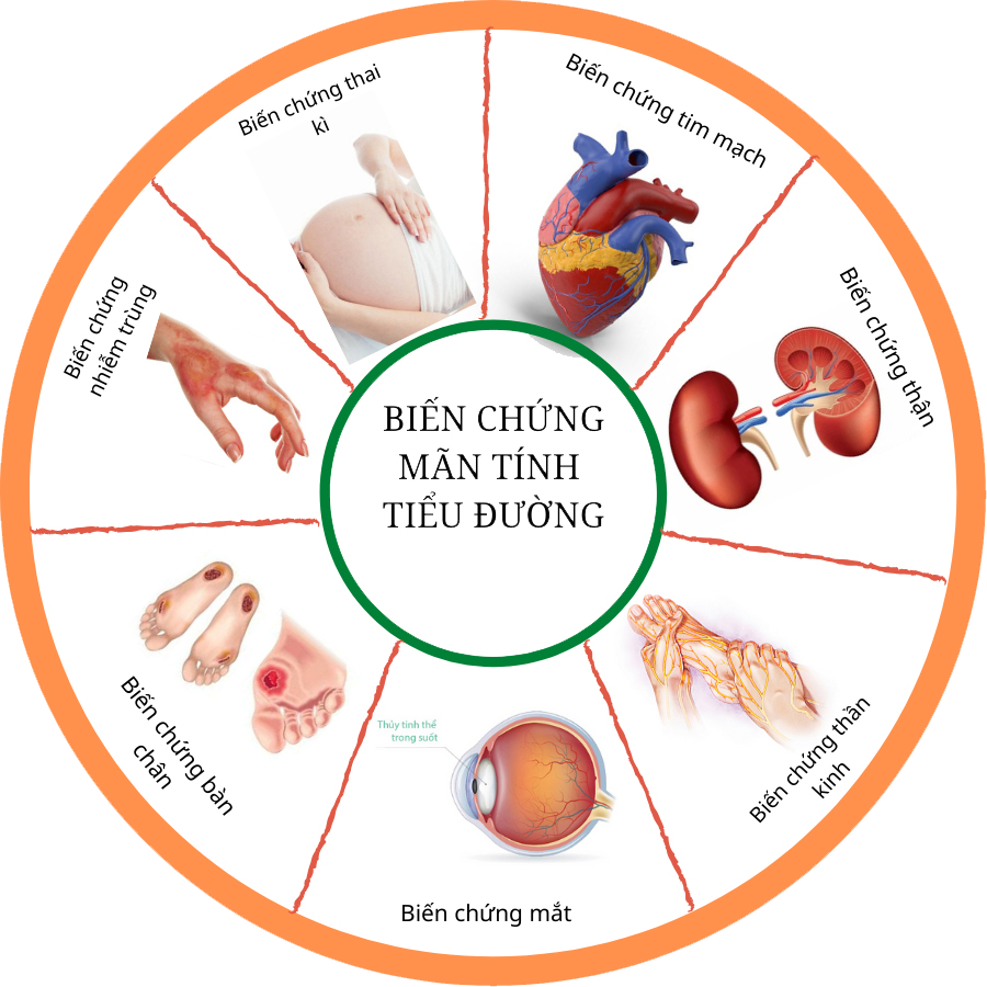 bien chung benh tieu duong