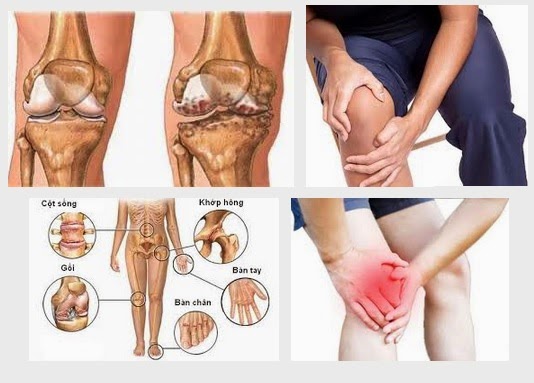 Đau nhức xương khớp ở người già