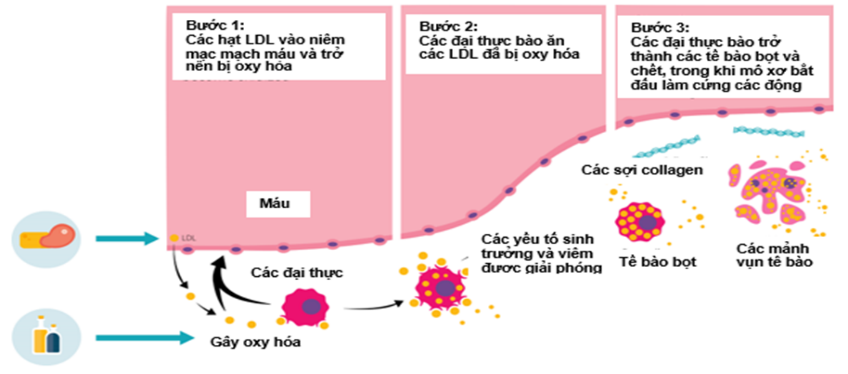 hinh1