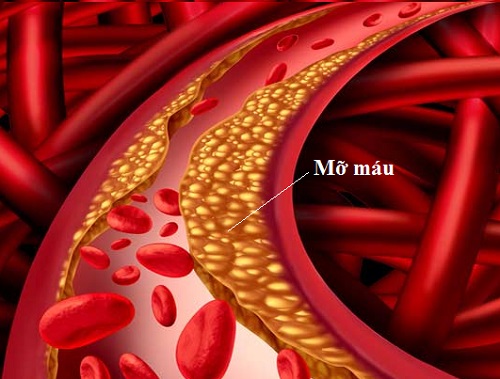 Mỡ trong máu