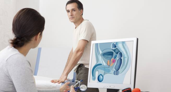Khi nào nên mổ u xơ tuyến tiền liệt