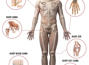 Những bệnh xương khớp thường gặp và cách phòng tránh
