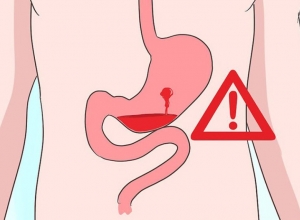 Xuất huyết dạ dày do đâu? 10 nguyên nhân gây xuất huyết dạ dày