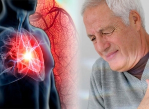 Cách phòng tránh bệnh đột quỵ mùa đông bạn nên biết