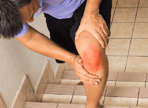 Đau đầu gối khi lên xuống cầu thang nguy hiểm không?