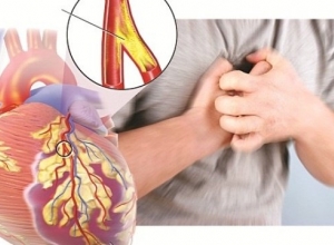 Mẹo dưới đây giúp bạn giảm những cơn đau thắt ngực hiệu quả