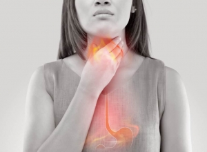 Top những cách chữa ợ nóng do trào ngược dạ dày hiệu quả tại nhà