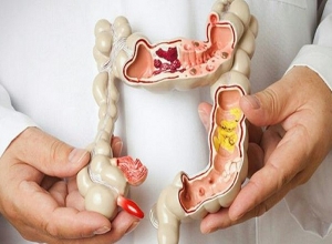 Trĩ ngoại độ 2 có nguy hiểm không? Tìm hiểu ngay để biết