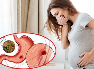 Phụ nữ khi mang thai bị đau dạ dày thì phải làm sao?