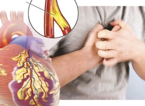 Bệnh suy tim độ 1 có nguy hiểm không? Tìm hiểu ngay để biết