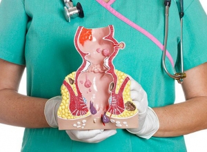 Dấu hiệu nhận biết trĩ huyết khối và cách điều trị hiệu quả