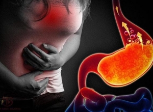Chữa trào ngược dạ dày bằng thuốc nam liệu có hiệu quả không? Tìm hiểu ngay để biết