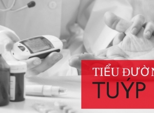 Cảnh báo: 5 triệu chứng tiểu đường giai đoạn đầu của tiểu đường tuýp 2 bạn cần đặc biệt lưu ý