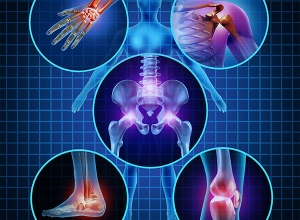 Thoái hóa khớp: 9 biện pháp làm giảm triệu chứng bệnh hiệu quả