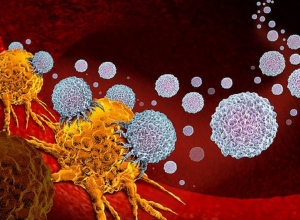 15 dấu hiệu cảnh báo sớm bệnh ung thư, tuyệt đối không được chủ quan