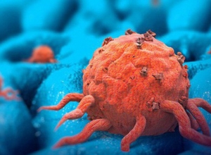 15 bộ phận cơ thể có nguy cơ bị ung thư nhất, tuyệt đối không được chủ quan