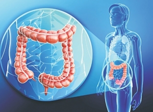 Ung thư trực tràng có nguy hiểm không? Tìm hiểu ngay trước khi quá muộn