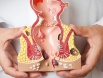 Ai là người dễ mắc phải ung thư hậu môn? Tìm hiểu ngay để biết