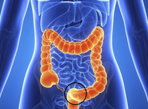 Nhận biết ngay 7 dấu hiệu ung thư đại trực tràng trước khi quá muộn