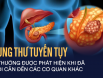 Ung thư tuyến tụy: Có những biện pháp điều trị nào?