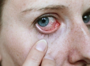 Ung thư mắt: Mối nguy hiểm tiềm ẩn bạn nên biết