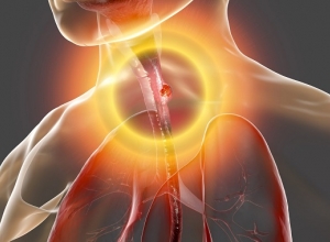 Ung thư thực quản: Khi nào cần gặp bác sĩ?