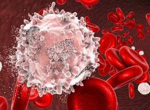 Nguyên nhân gây ung thư máu là gì?