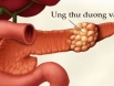 Dấu hiệu nào cảnh báo bệnh ung thư dương vật?