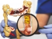 Gợi ý 4 phương pháp điều trị ung thư trực tràng, có thể bạn chưa biết