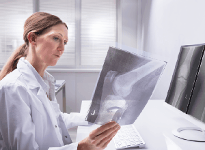 Những ai dễ mắc bệnh ung thư xương? Tìm hiểu ngay trước khi quá muộn