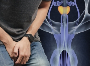 Ung thư tinh hoàn sống được bao lâu? Tìm hiểu ngay để biết