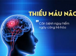 Dấu hiệu nhận biết bệnh thiếu máu não, liệu bạn đang có các triệu chứng này?