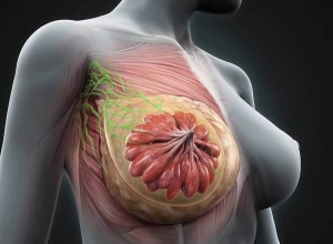 Phẫu thuật điều trị ung thư vú: Bạn sẽ có những lựa chọn nào?