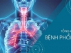 Bệnh phổi kẽ: Nguyên nhân và cách điều trị hiệu quả