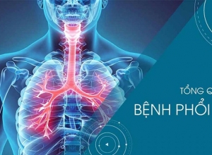 Bệnh phổi kẽ: Nguyên nhân và cách điều trị hiệu quả