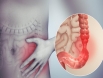 Ung thư ruột non: Những yếu tố nào làm tăng nguy cơ mắc bệnh?