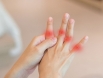 Viêm khớp ngón tay: Khi nào cần gặp bác sĩ?