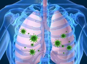 Bệnh viêm phổi gây nguy hiểm tới người bệnh như thế nào?