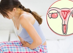 Nữ giới nên phòng ngừa và điều trị viêm phụ khoa như thế nào?