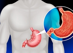 Đâu là những dấu hiệu sớm của chứng trào ngược dạ dày? Tìm hiểu ngay để biết