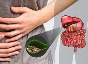 Chữa sỏi mật bằng mẹo dân gian liệu có hiệu quả như lời đồn?