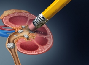 Kim tiền thảo có chữa được sỏi thận không? 