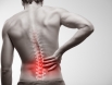 Thoát vị đĩa đệm ở người trẻ tuổi - Điều trị như nào cho hiệu quả?