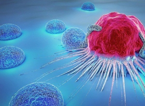 Cảnh báo 11 dấu hiệu ung thư tuyến tụy cần đặc biệt đề phòng