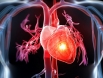 Rối loạn nhịp tim - Có thể bạn chưa biết