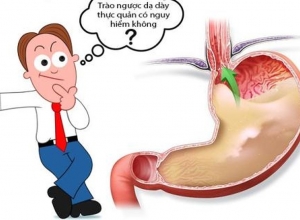 Bị trào ngược dạ dày có nguy hiểm không? Cách đối phó với bệnh trào ngược dạ dày.