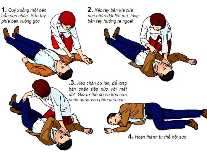 Dấu hiệu cảnh báo đột quỵ trước 1 tuần mà mọi người cần đặc biệt lưu ý