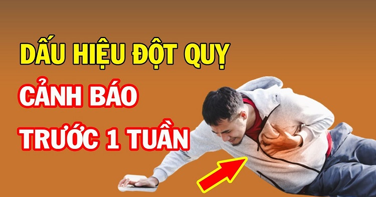 Dấu hiệu cảnh báo đột quỵ trước 1 tuần mà mọi người cần đặc biệt lưu ý